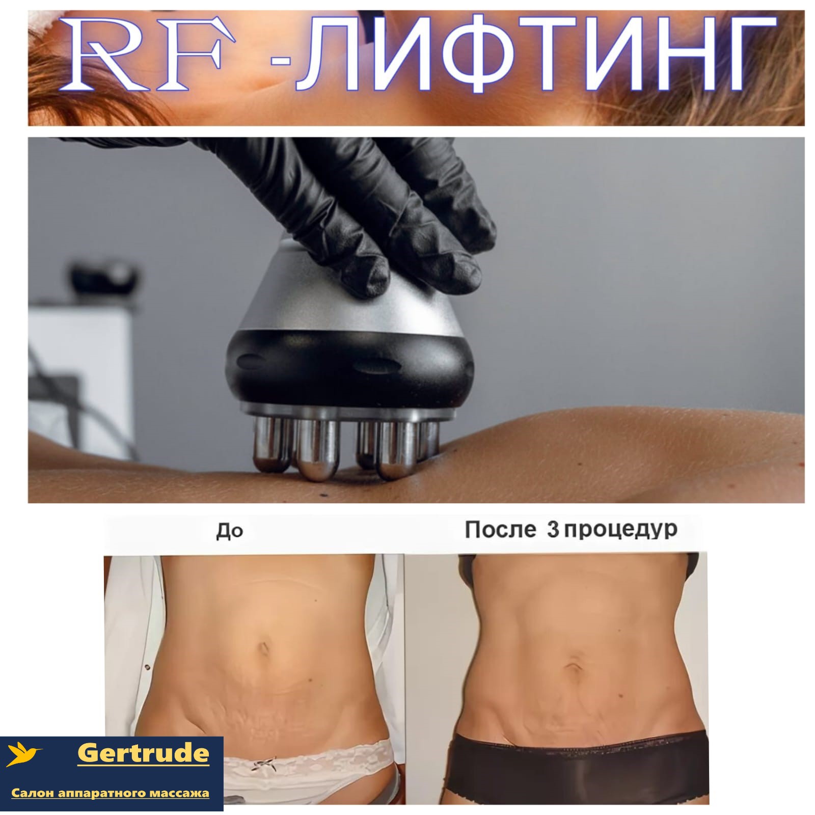 RF лифтинг лица тела Краснодар