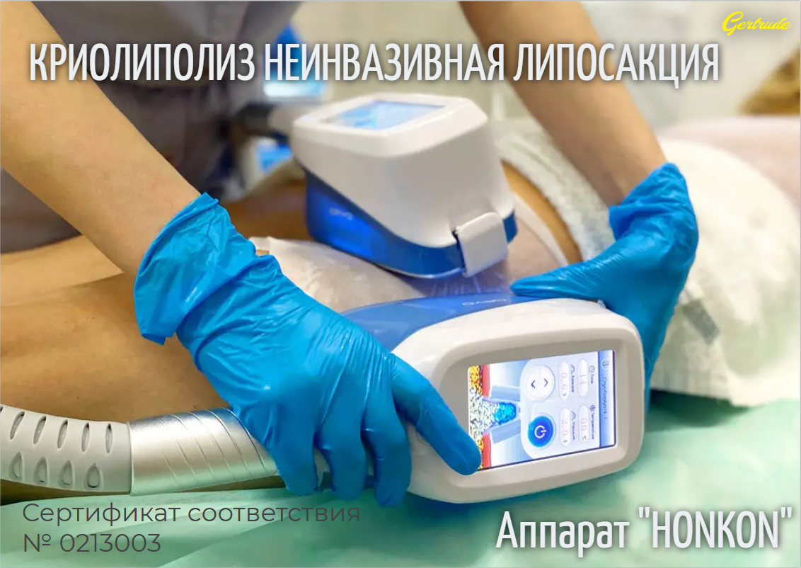 Липосакция не инвазивная в Краснодаре «Криолиполиз»